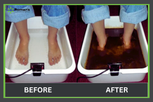 Ioncleanse detox foot bath in Morgantown, WV - Roman's Wellness Center Blog