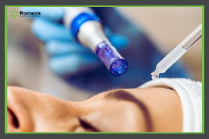 Microneedling for skin tightening blog at Roman's Wellness Center Morgantown, WV