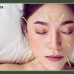 Notox - Botox Alternatives in Morgantown, WV - Roman's Wellness Center