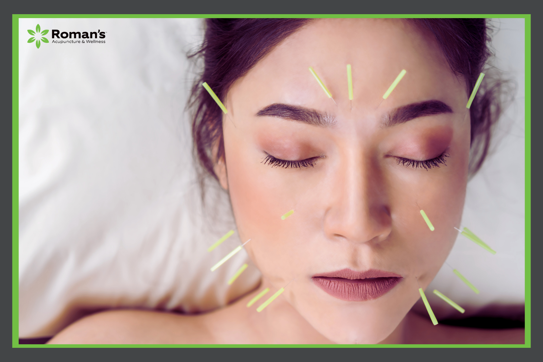 Notox - Botox Alternatives in Morgantown, WV - Roman's Wellness Center