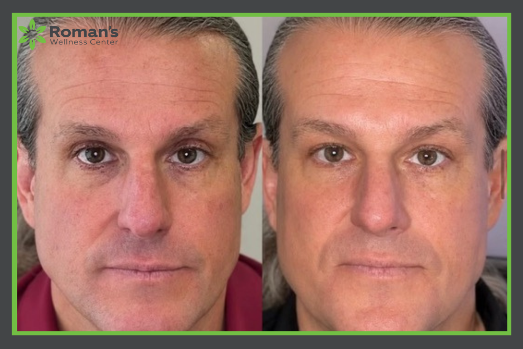 Aesthetic Treatments Morgantown WV Romans Wellness Center